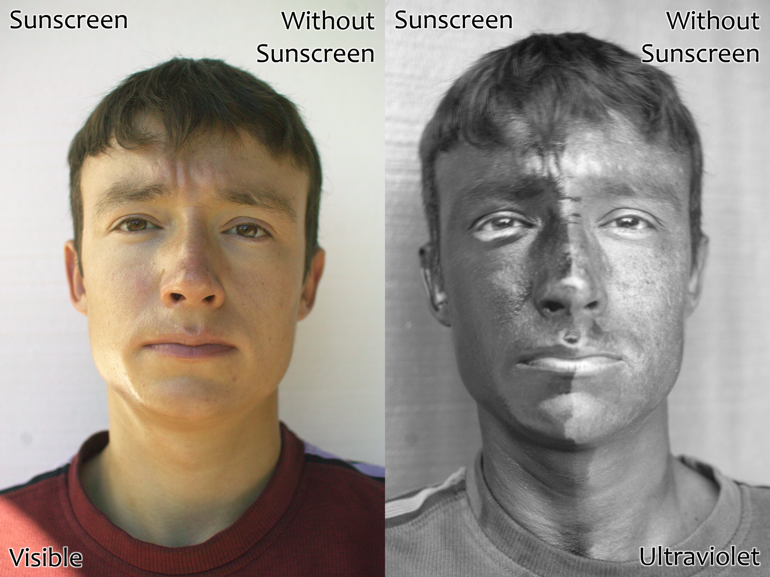 A face photographed in visible light and ultraviolet light showing sunscreen absorbing UV