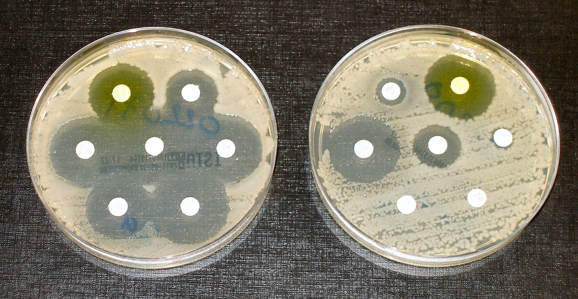 Two petri dishes comparing bacteria that are sensitive and resistant to antibiotic discs