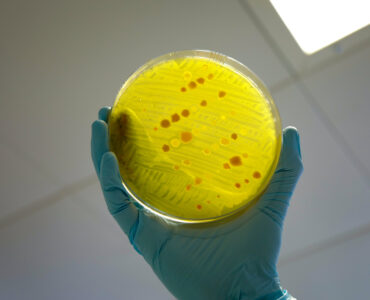 A gloved hand holding a petri dish used for antimicrobial resistance testing