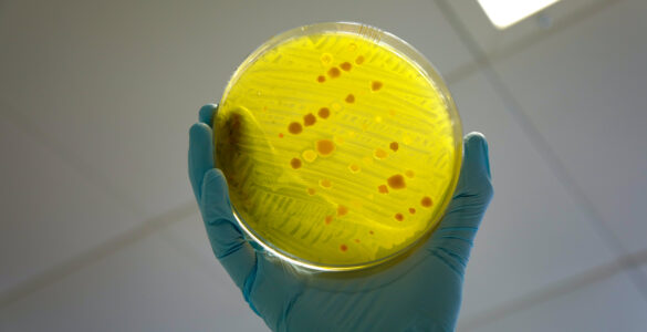 A gloved hand holding a petri dish used for antimicrobial resistance testing