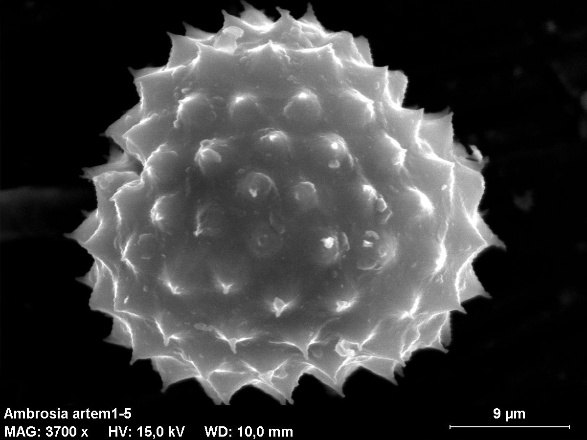 Ragweed pollen grains seen under a scanning electron microscope