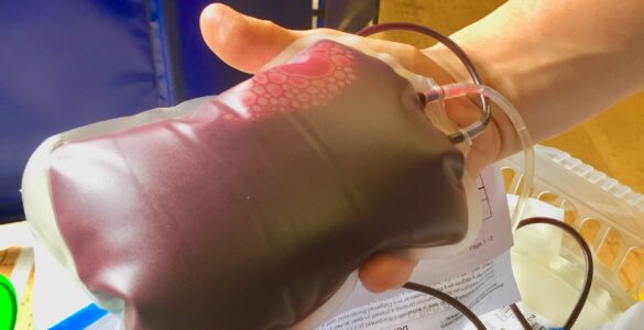 A nurse holding a freshly donated unit of blood beside sample tubes used for safety testing.