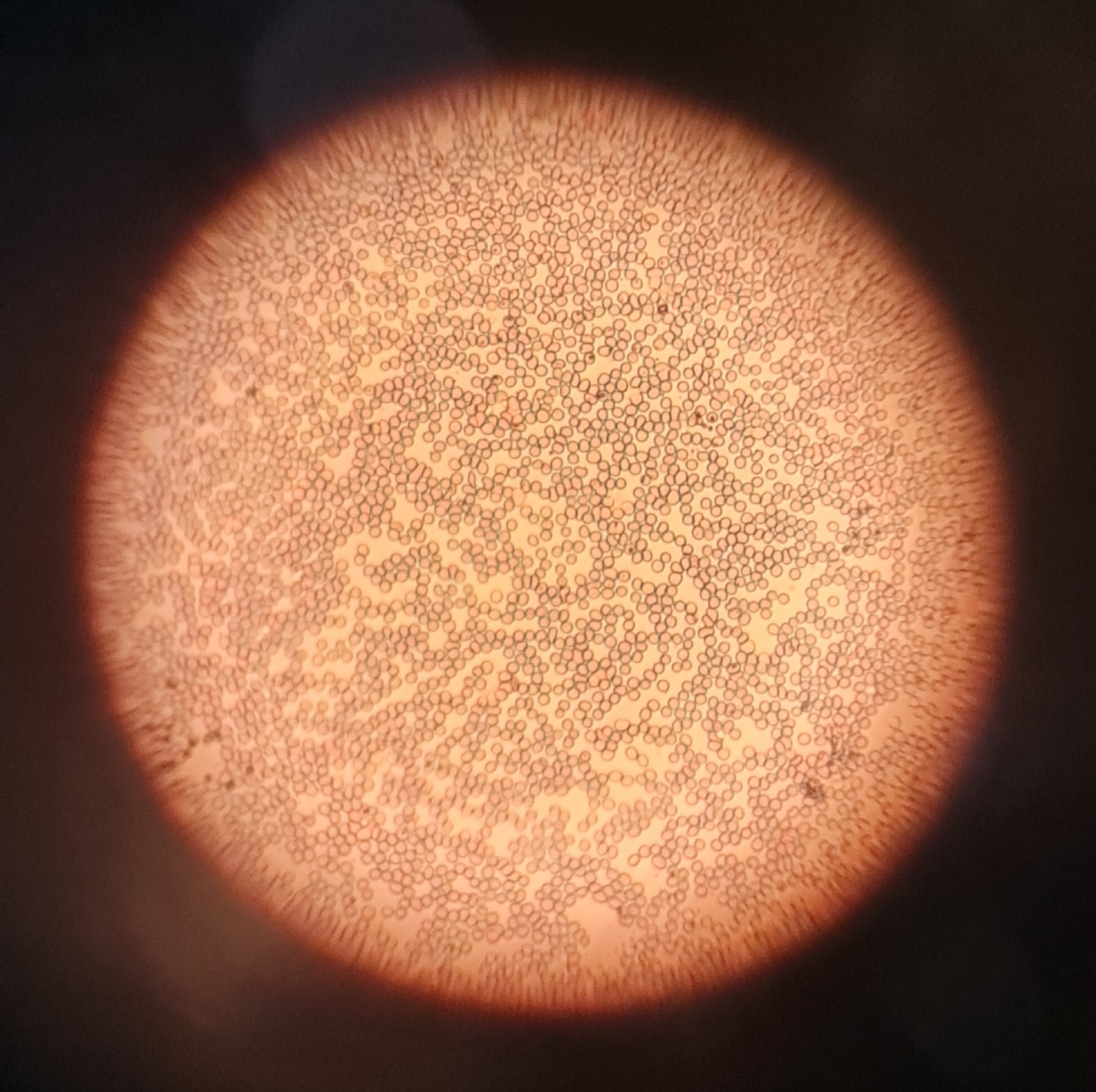 Red blood cells viewed through a microscope, showing the cells whose surface antigens determine transfusion compatibility.